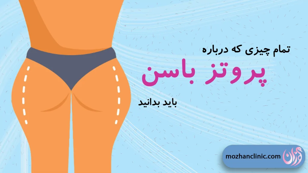 پروتز باسن
