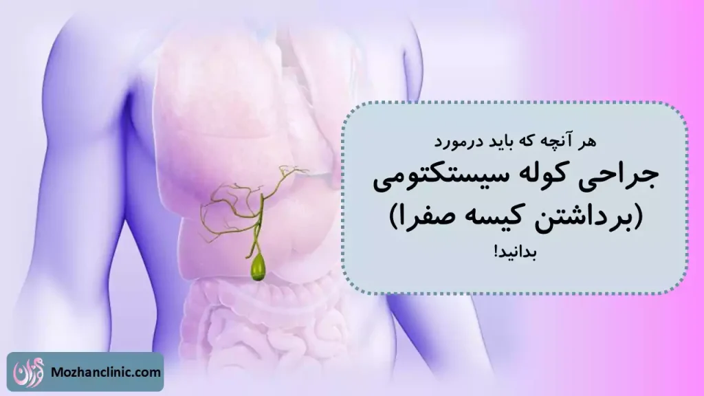 کوله سیستکتومی یا جراحی برداشتن کیسه صفرا