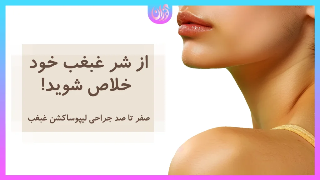 لیپوساکشن غبغب