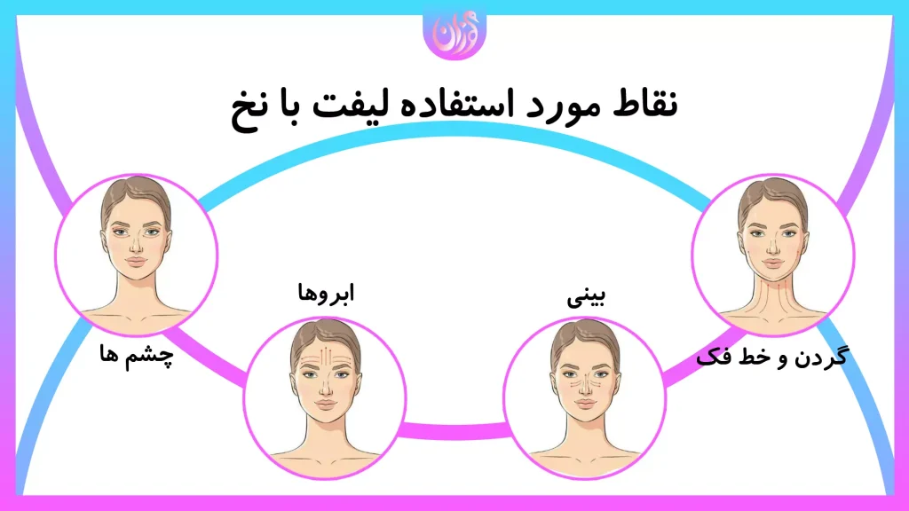 لیفت با نخ برای درمان کدام نواحی مورد استفاده است؟